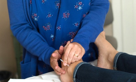 One Acupuncture Initial Consultation and Session - Longevity Health Center