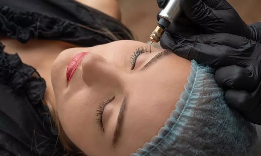 Up to 30% Off on Non-Surgical Brow/Forehead Lift at Sculpt and Skin Care