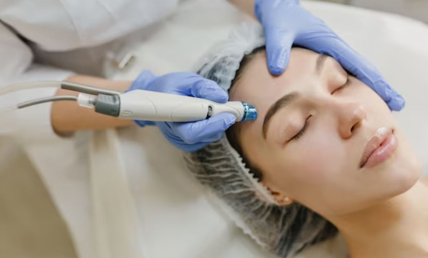 Image 1: Revitalizing Micro-needling Sessions for Youthful and Firm Skin!
