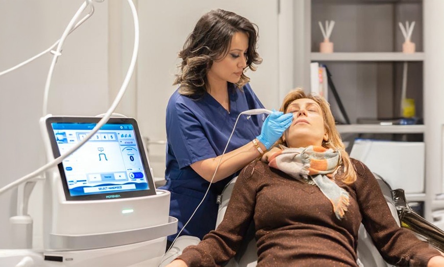 Image 3: Laser Thread Vein Removal on One, Two, or Four Areas; Face or Leg