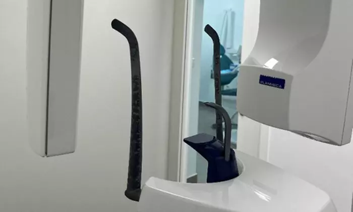 Higiene bucal completa en Clínica dental Dr. Pablo Muñoz