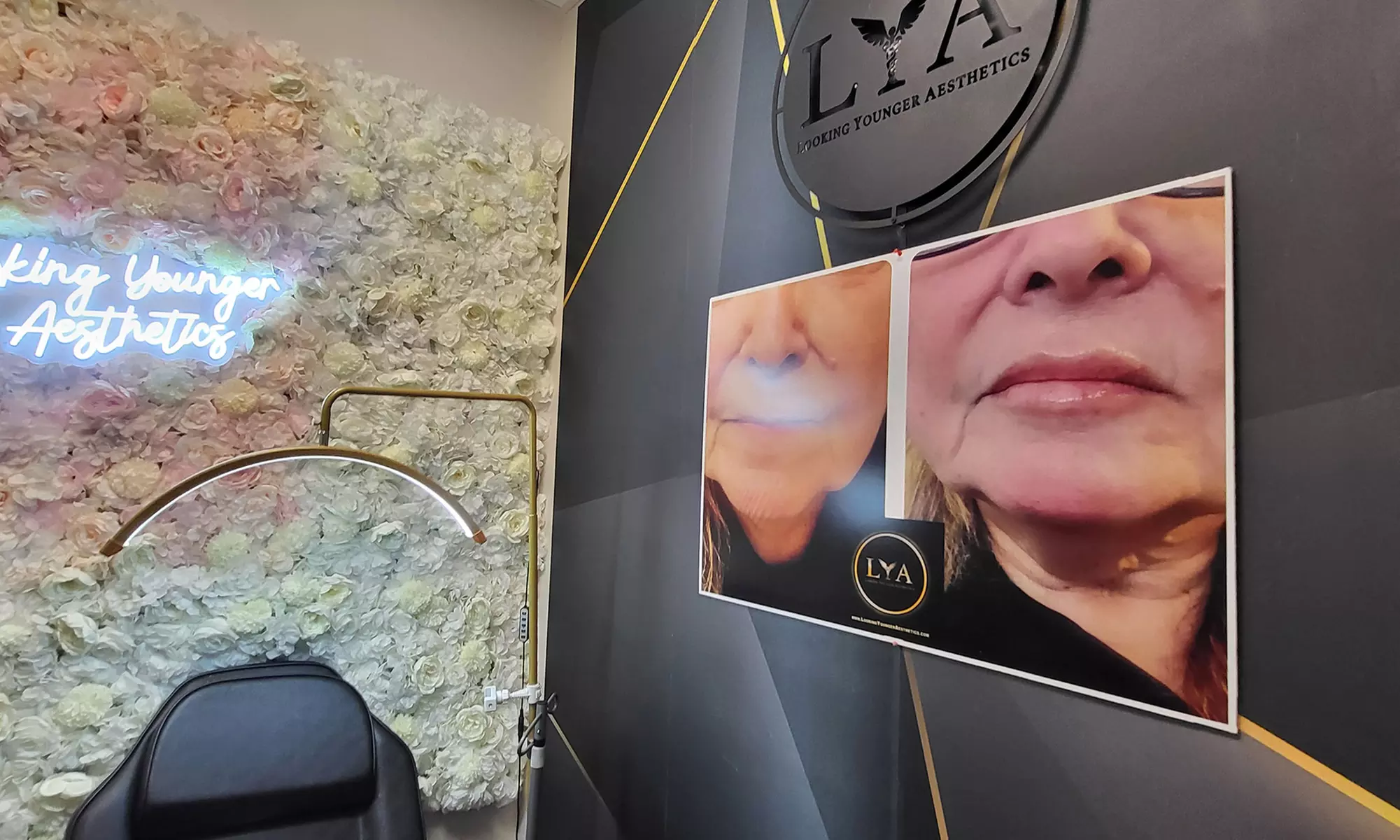 Achieve a Youthful Look With 20, 40, or 60 Units of Botox