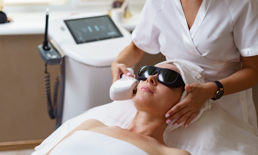 Image 1: Sessions of IPL Photo Facial at NiaSol Anti-Aging & Laser Clinic