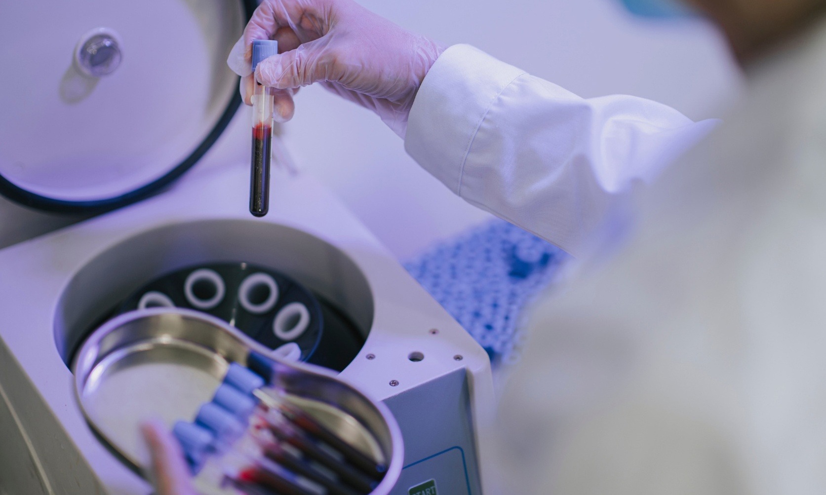 PRP Treatment for Hair loss or Face (One Area) Revitalization