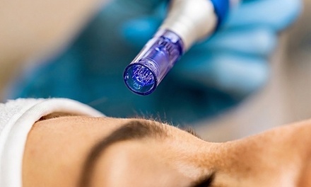 One Micro-Needling Treatment with Hyaluronic Acid - Bare Skin Beauty