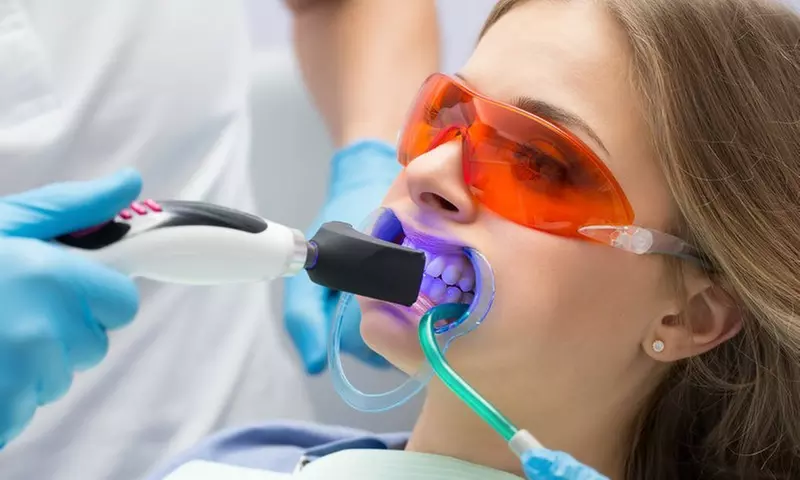 1 o 2 sesiones de blanqueamiento dental con limpieza bucal y revisión con hasta un 67% de descuento - Primary Image