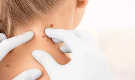 1 sesión de plasma pen (lifting sin cirugía) en zona facial de código de barras - Alejandra Quiroz Estética y Bienestar