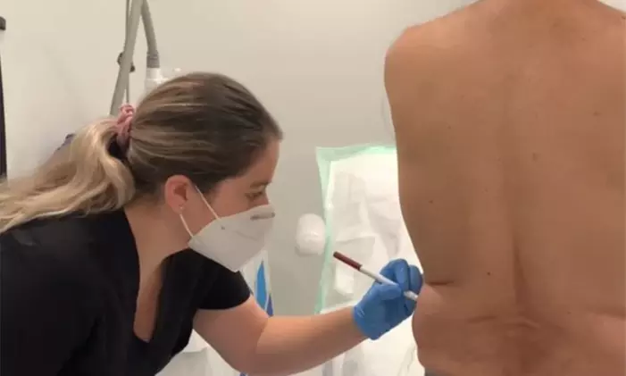 Experience body contouring with 1 CoolSculpting session