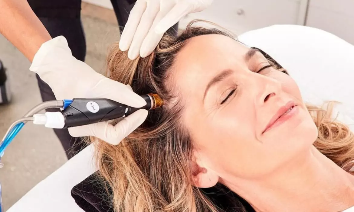 One Microneedling Treatment OR One HydraFacial Keravive Scalp Treatment at Marigold Skin Lab (Up to 42% Off) - Primary Image