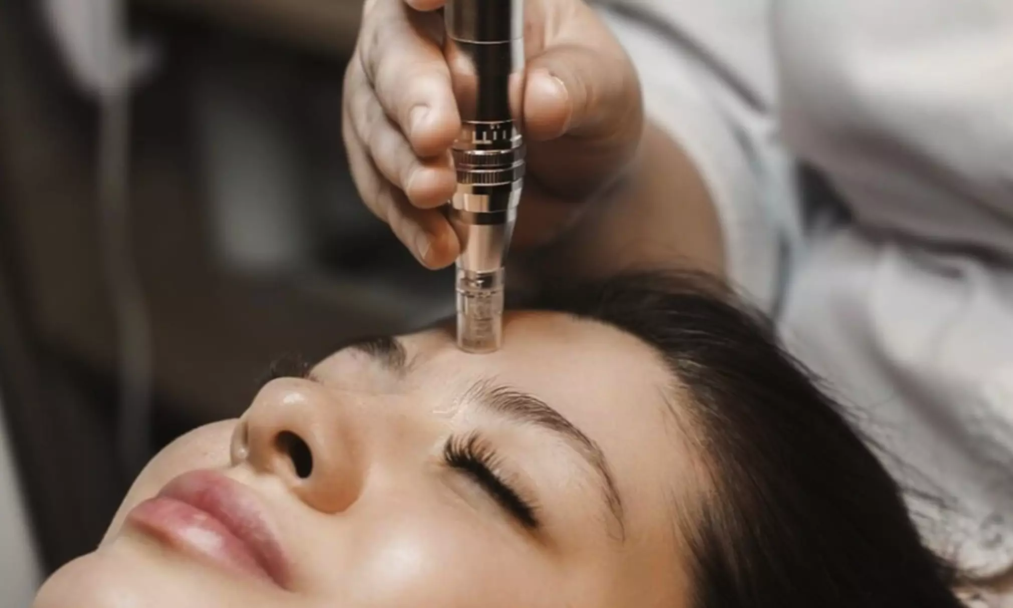 Up to 41% Off on Micro-Needling at Darling Med Spa - Primary Image