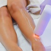 Image 2: Laser hair removal for multiple areas, up to 60% off