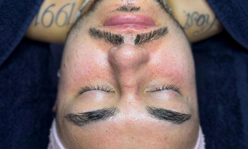 Image 3: Divine Aura Esthetics: Dermaplaning Facials with Lymphatic Massage