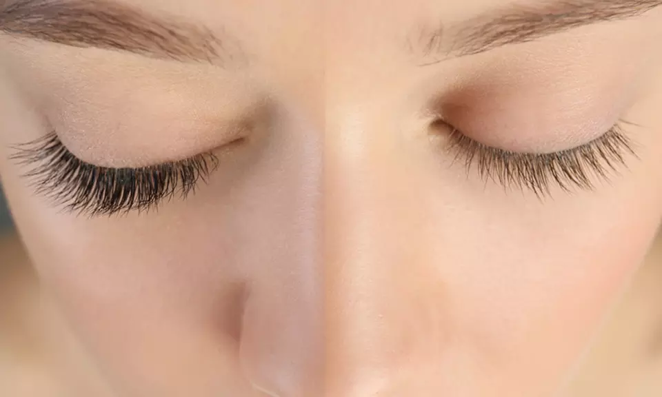 Classic or Volume Set of Eyelash Extensions at You On Crown