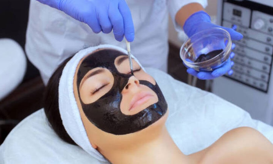 Image 4: Higiene facial con opción a Hydrafacial, Hollywood peeling o más 