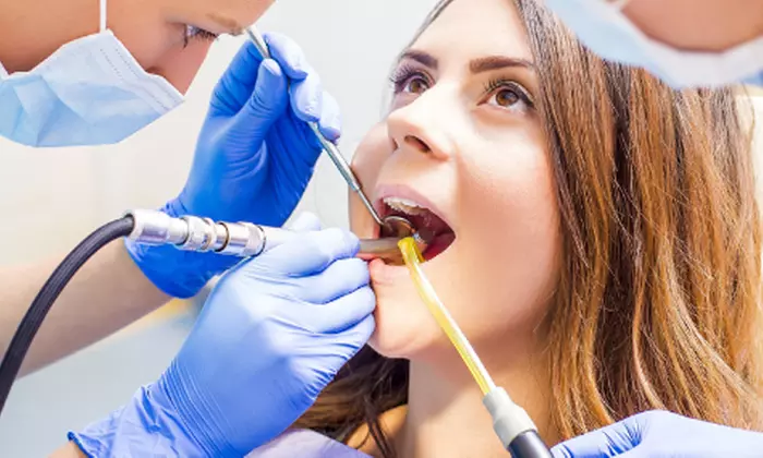 Up to 50% Off on Dental Filling at Todays Dental @ Lexington - Primary Image