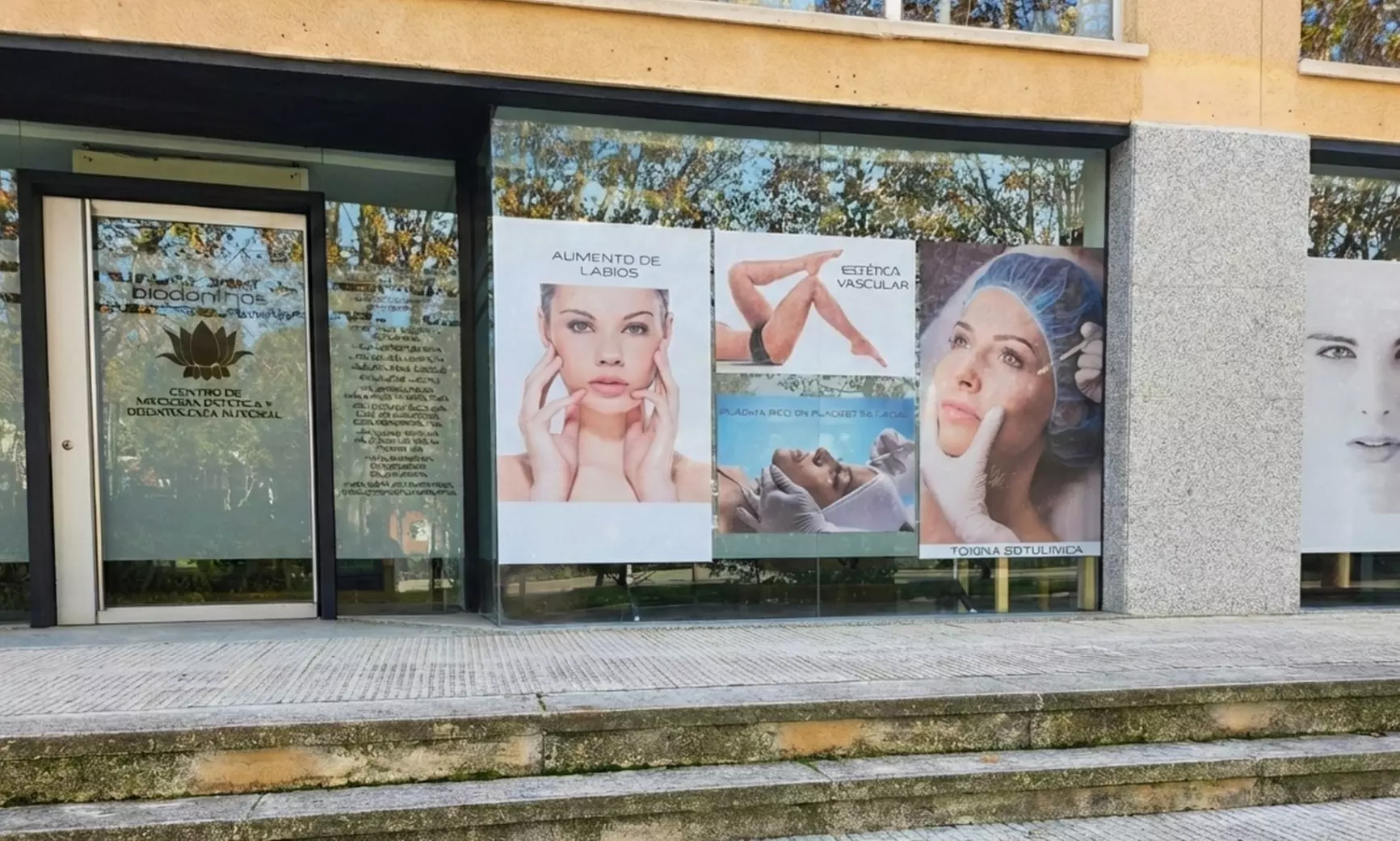 Eliminación de várices con tecnología avanzada