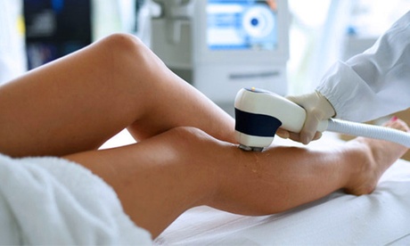 4 sedute di epilazione laser su zone a scelta al centro EsteticaMente Di Marta Viano (sconto fino a 92%)