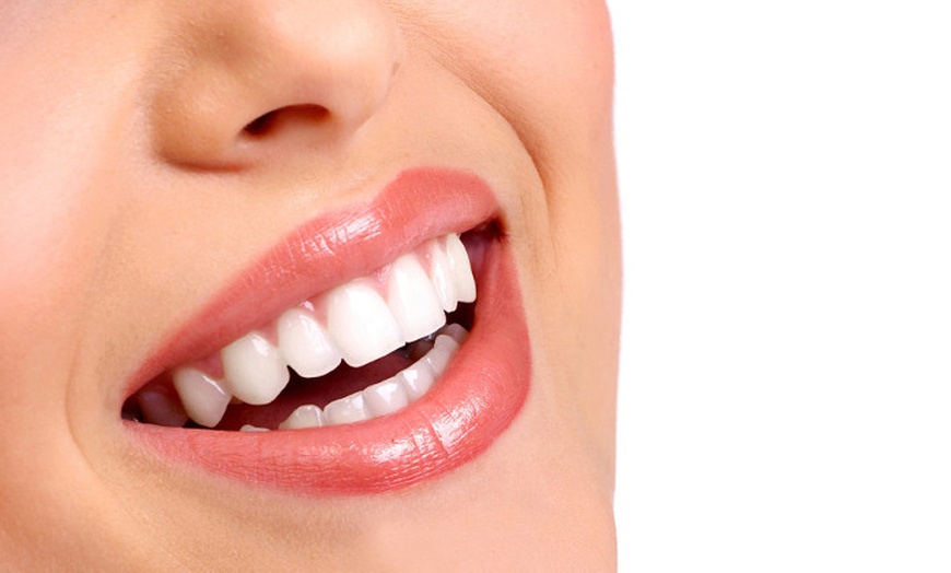 Image 1: Zoom Teeth Whitening