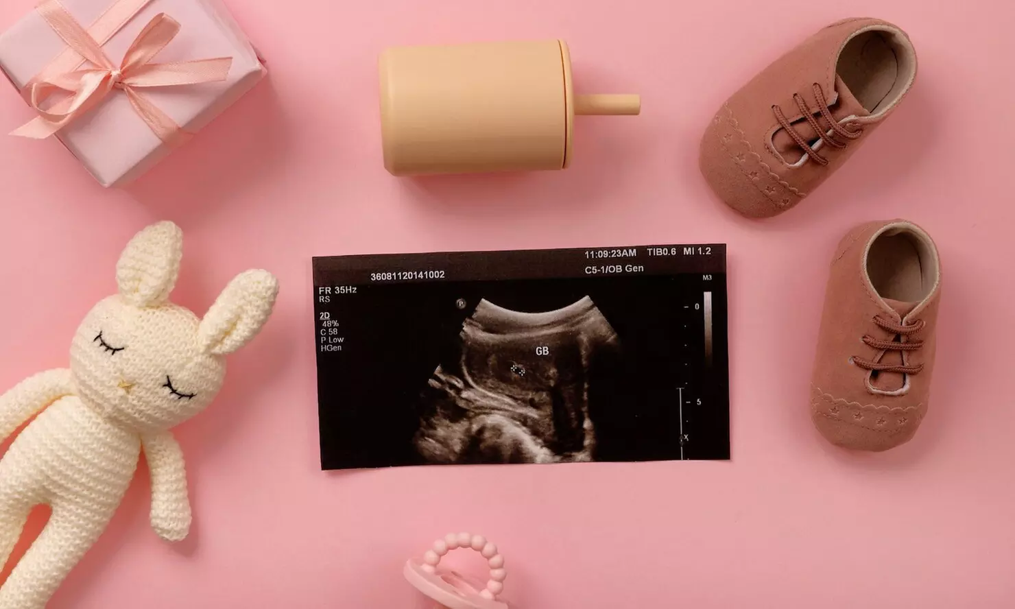 Ecografía ECO5D: Fotos, video y latido en tu móvil desde la semana 7