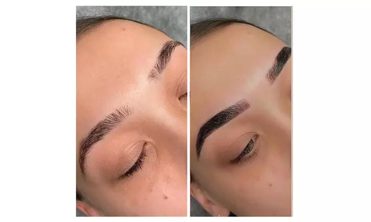 Spend $99 for Any Treatment With a $150 Value