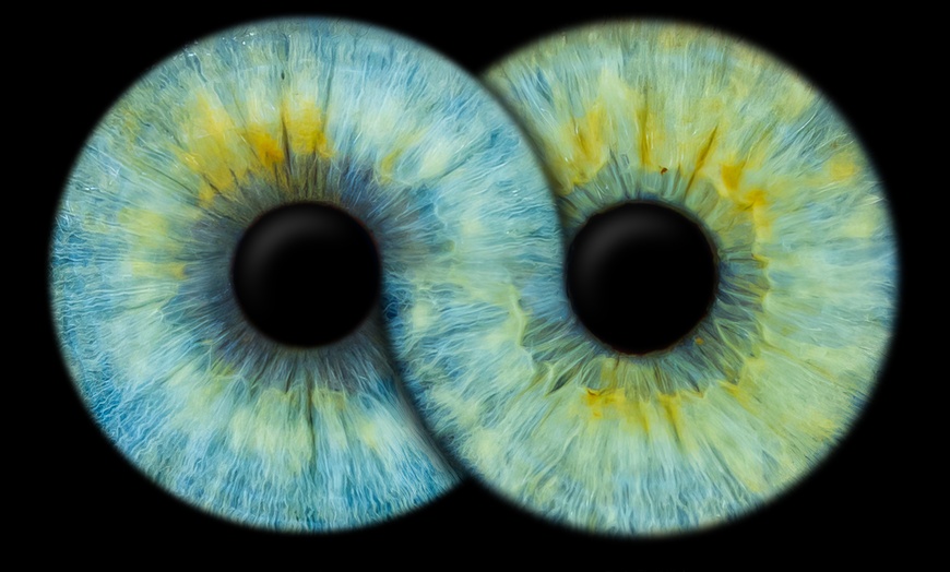 Image 5: Odkryj magię spojrzenia: zdjęcia Twojej tęczówki w artystycznej formie