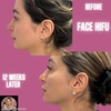 Image 4: Revitalize with HIFU Face Treatment for Face with/without Neck