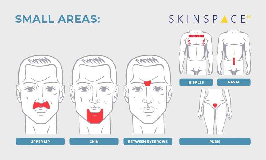 Image 4: Three or Six Sessions of Laser Hair Removal at SkinSpaceUK