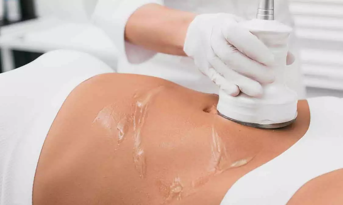 2 Fat Cavitation Treatments with Lymphatic Drainage Cupping