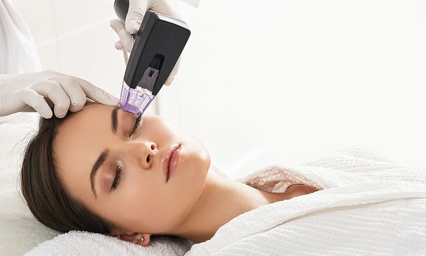 Image 1:  Morpheus8 Microneedling for Face at Purely Natural Med Spa