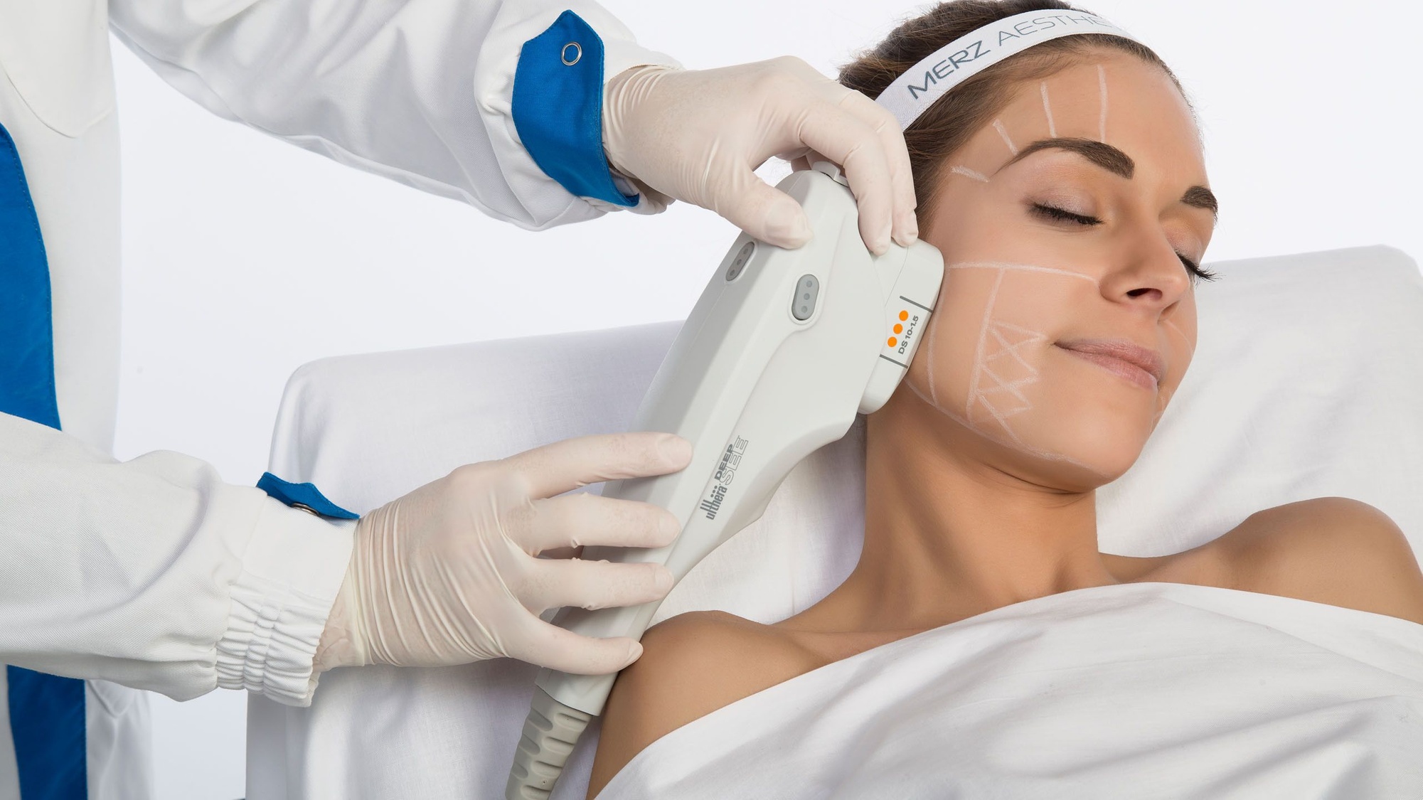 Refresh Your Skin with Ultherapy for Choice of Area at Dermix Med Spa