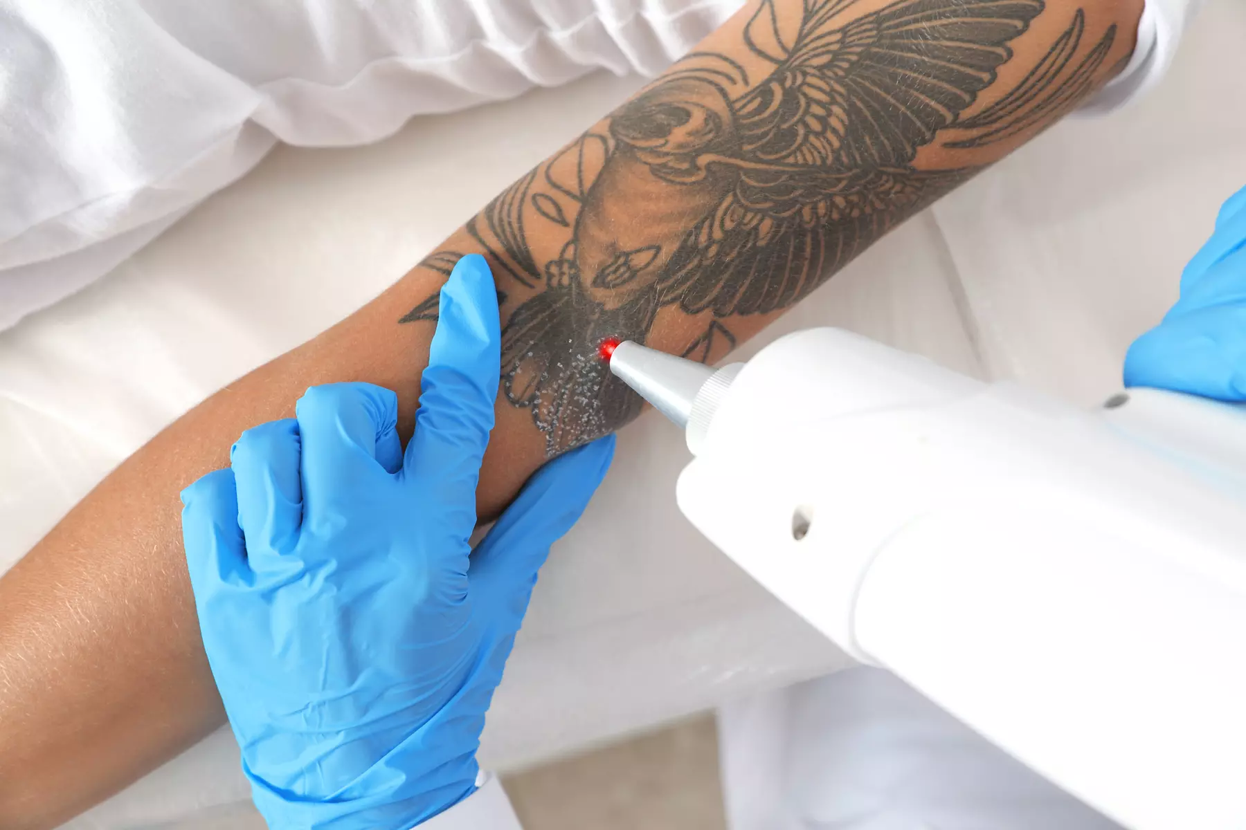 Up to 55% Off on Tattoo Removal at Haus of Skin