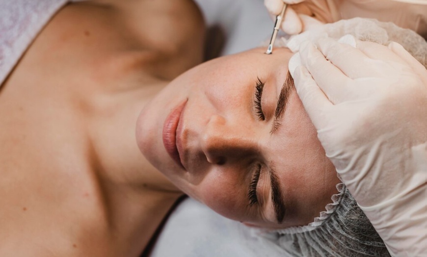 Image 1: 1 o 2 sesiones de Dermapen facial con cóctel de vitaminas 