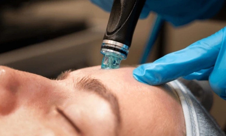 Image 10: Limpieza facial a elegir con opción a hydrafacial y máscara led