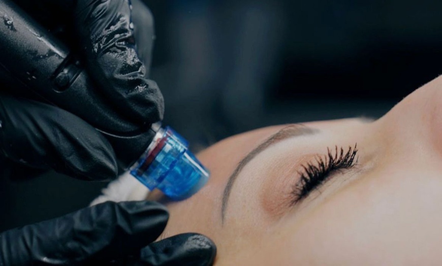 Image 3: Hydrogen-Gesichtsbehandlung/ Microneedling/ Microdermabrasion