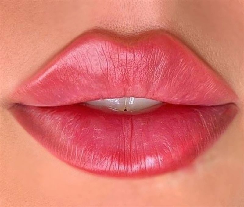 Up to 60% Off Russian Lip Filler at LaBelle MedSpa