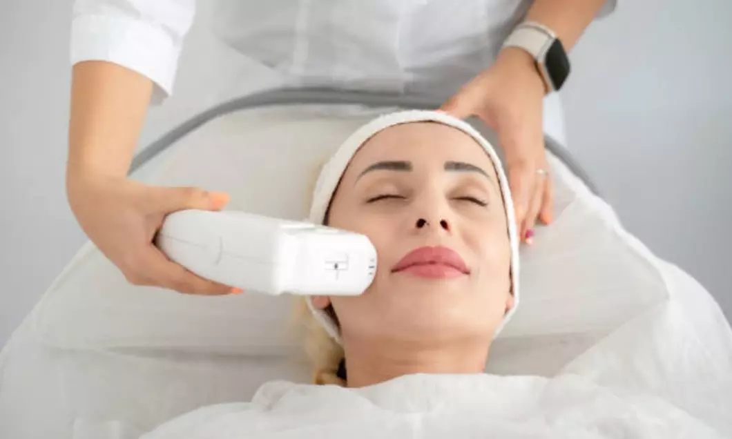 Sesión de tratamiento HIFU facial en una zona o rostro completo