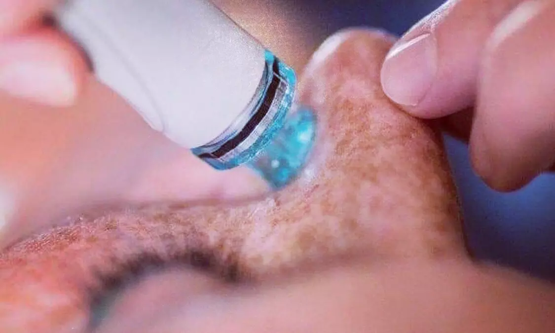 Hydrogen-Gesichtsbehandlung