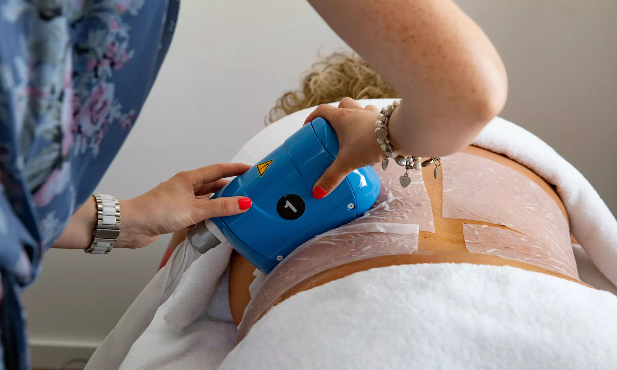 Bis zu 67% Rabatt auf Kryolipolyse bei Körperhaus Köln