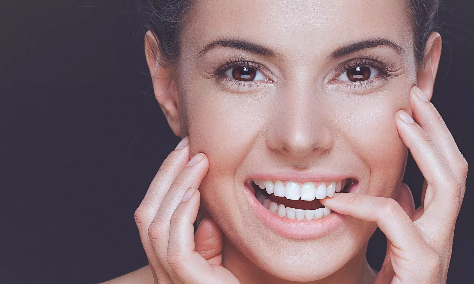 Kosmetisches Zahn-Bleaching bei KONZEPT WEISS Köln: Natürliche Inhaltsstoffe für weiße Zähne (bis zu 47% sparen) - Primary Image