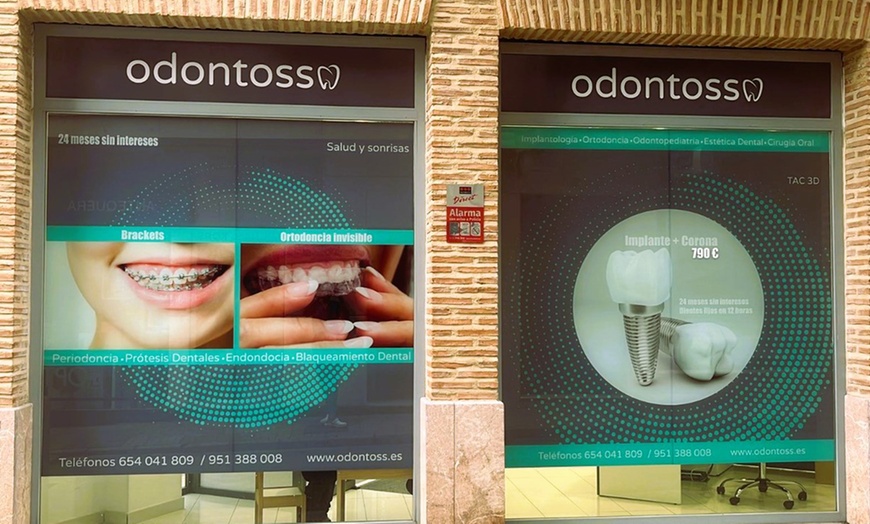 Image 7: Sesión de blanqueamiento led en Clínica dental Odontoss Antequera