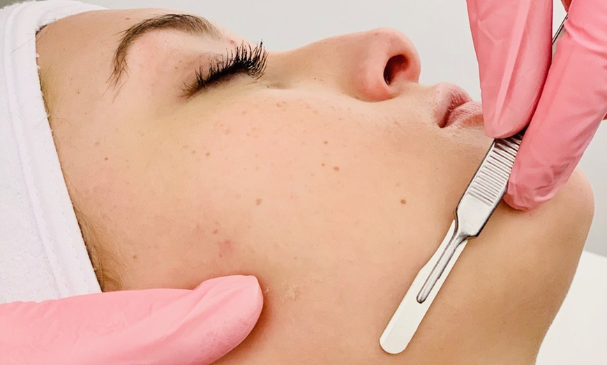 Image 2: Hydro Facial, Chemical Peel, or 3-Facial Series at Adriana Skincare