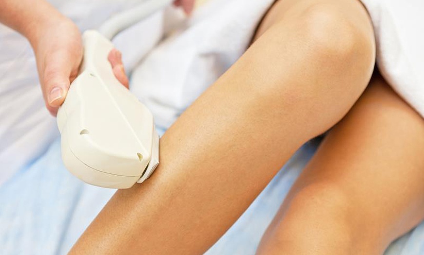 Image 5: (Up to 60% Off) Six Laser Hair Removal Sessions on One Small, Medium or Large Area at Beautiful Orlando 