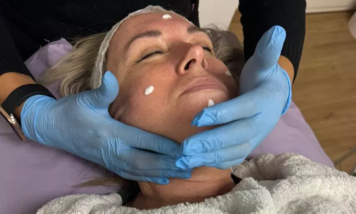 Limpieza facial con opción a microdermoabrasión para 1 persona