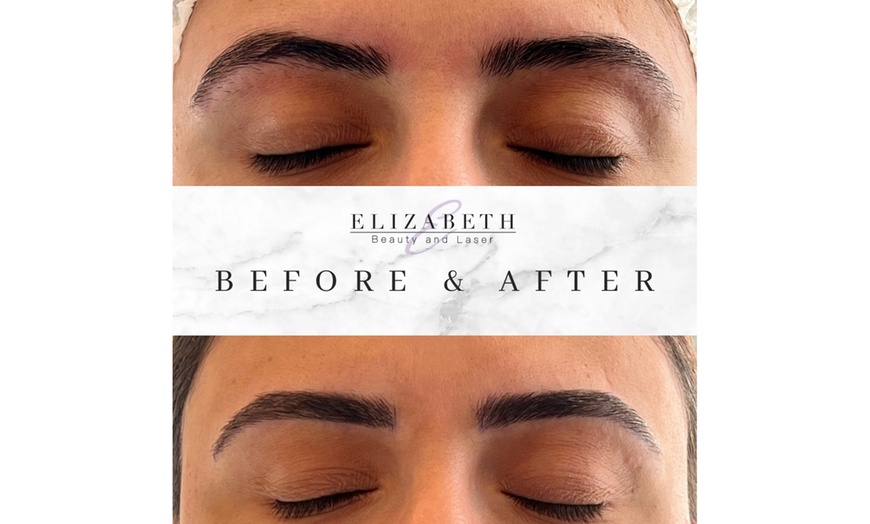 Image 4: Microblading Session with Touch Up at Elizabeth Beauty and Laser