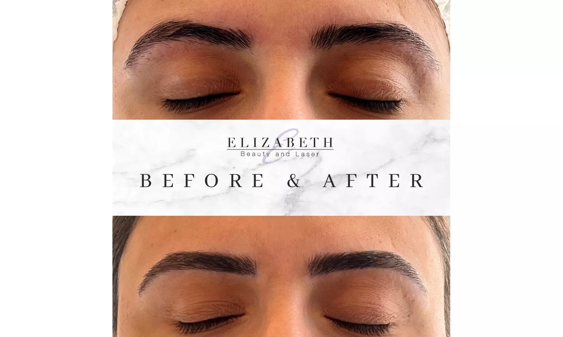 Microblading Session at Elizabeth Beauty and Laser – Professional Brow Enhancement