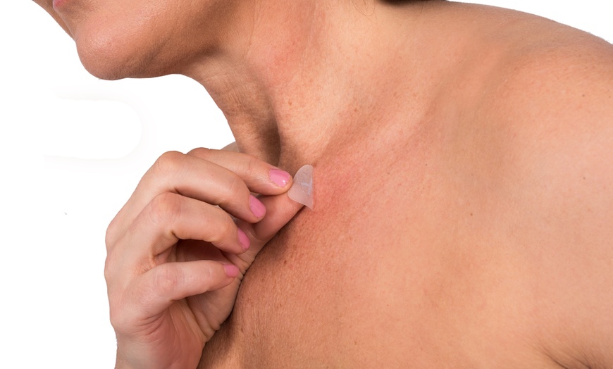 Image 7: Bioclear Skin Tag Patches