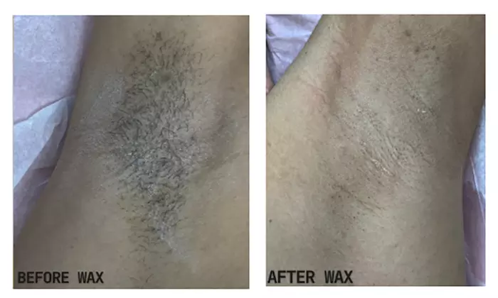 Get Smooth Skin with Brazilian and Optional Underarm Wax Packages