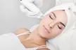 Rejuran Skin Booster Microneedling & LED Therapy Sessions at Castillo Aesthetics for Skin Repair (Up To 64% Off) - Image 3