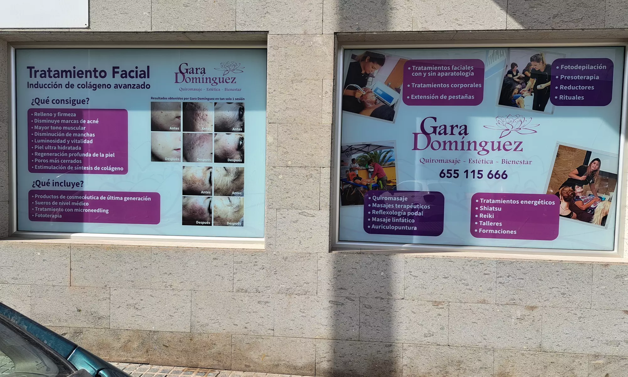 Renueva tu piel con una limpieza facial con tratamiento antiarrugas, masaje y más para 1, ahorra hasta un 60% - Image 7