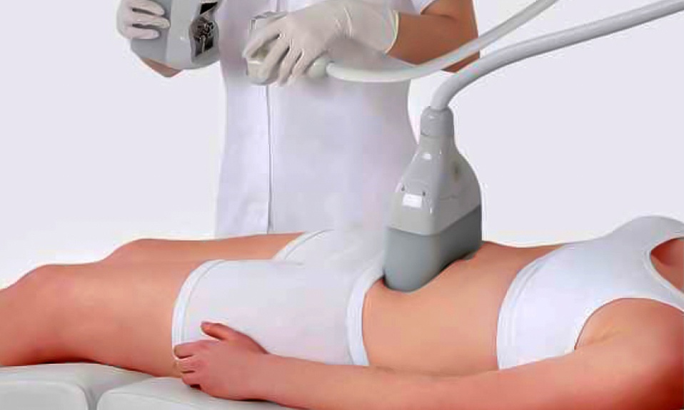 Cryolipolyse avec bilan au Point Soleil Paris 12 Daumesnil